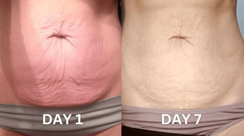 Natural non-invasive formula